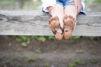Treating Flat Feet in Children